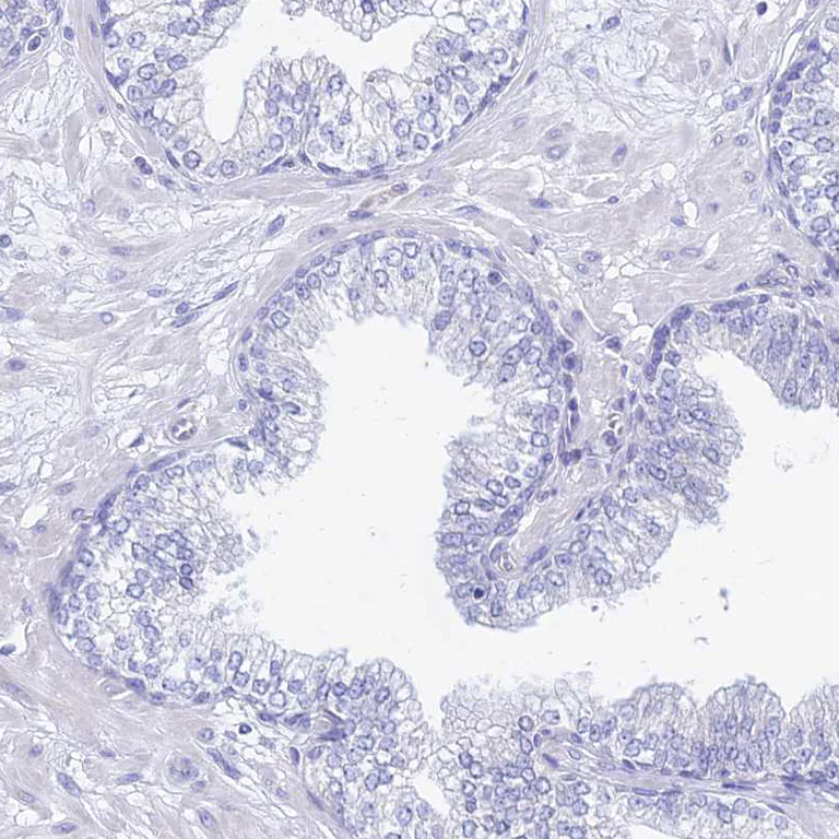 Immunohistochemistry (Formalin/PFA-fixed paraffin-embedded sections) - Anti-GNG13 antibody (AB126562)
