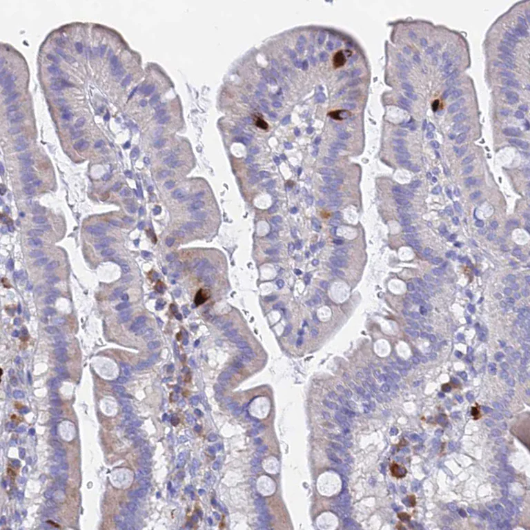 Immunohistochemistry (Formalin/PFA-fixed paraffin-embedded sections) - Anti-GNG13 antibody (AB126562)