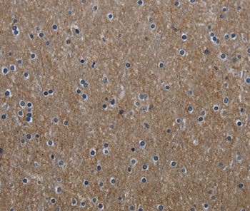 Immunohistochemistry (Formalin/PFA-fixed paraffin-embedded sections) - Anti-GNG2 antibody (AB198225), expandable thumbnail