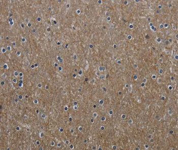 Immunohistochemistry (Formalin/PFA-fixed paraffin-embedded sections) - Anti-GNG2 antibody (AB198225)