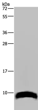 Western blot - Anti-GNG2 antibody (AB198225)
