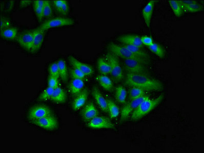 Immunocytochemistry/ Immunofluorescence - Anti-GNG4 antibody (AB238868)