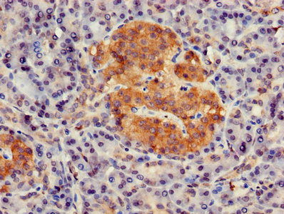 Immunohistochemistry (Formalin/PFA-fixed paraffin-embedded sections) - Anti-GNG4 antibody (AB238868)