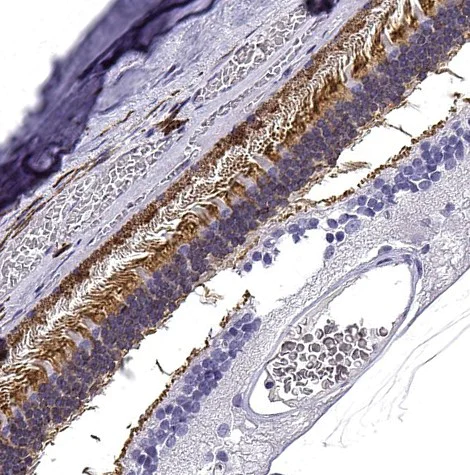 Immunohistochemistry (Formalin/PFA-fixed paraffin-embedded sections) - Anti-GNGT1 antibody (AB243448)