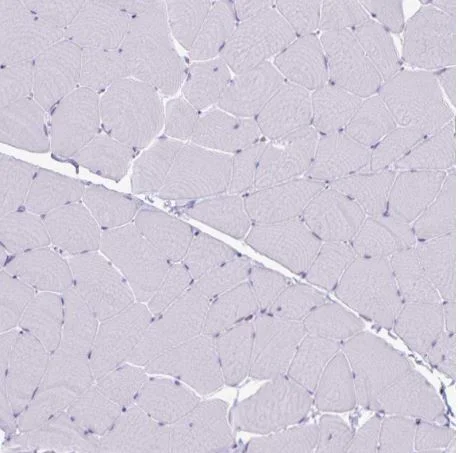 Immunohistochemistry (Formalin/PFA-fixed paraffin-embedded sections) - Anti-GNLY/Granulysin antibody (AB204594)