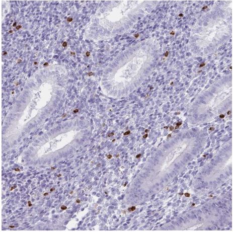 Immunohistochemistry (Formalin/PFA-fixed paraffin-embedded sections) - Anti-GNLY/Granulysin antibody (AB204594)