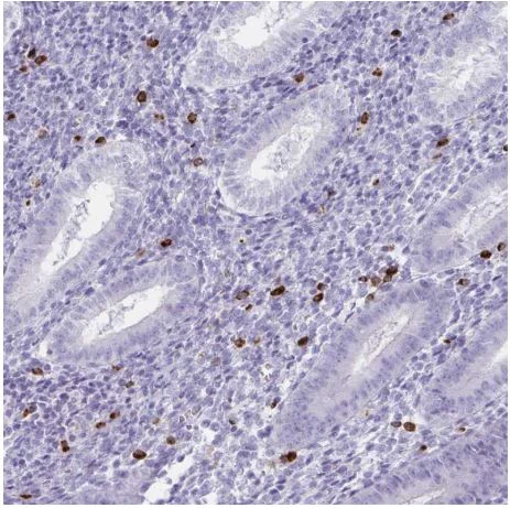 Immunohistochemistry (Formalin/PFA-fixed paraffin-embedded sections) - Anti-GNLY/Granulysin antibody (AB204594)