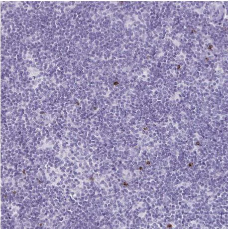 Immunohistochemistry (Formalin/PFA-fixed paraffin-embedded sections) - Anti-GNLY/Granulysin antibody (AB204594)