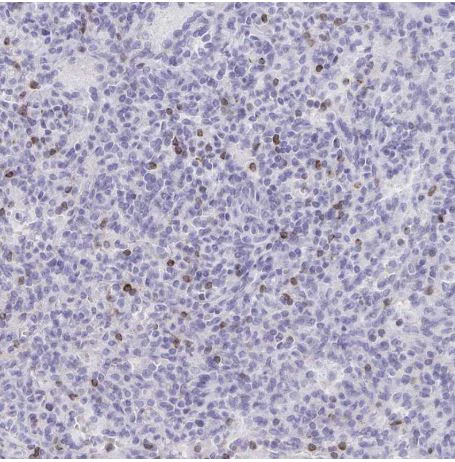 Immunohistochemistry (Formalin/PFA-fixed paraffin-embedded sections) - Anti-GNLY/Granulysin antibody (AB204594)
