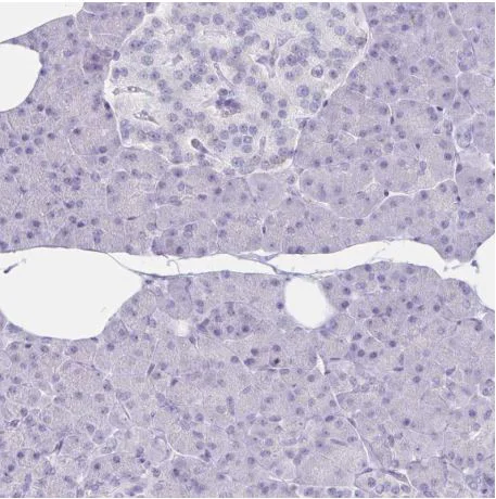 Immunohistochemistry (Formalin/PFA-fixed paraffin-embedded sections) - Anti-GNLY/Granulysin antibody (AB204594)