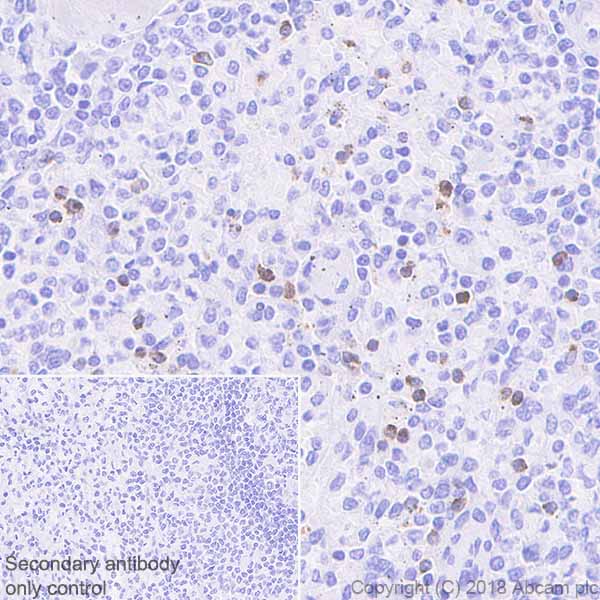 Immunohistochemistry (Formalin/PFA-fixed paraffin-embedded sections) - Anti-GNLY/Granulysin antibody [EPR22110-101] (AB241333), expandable thumbnail