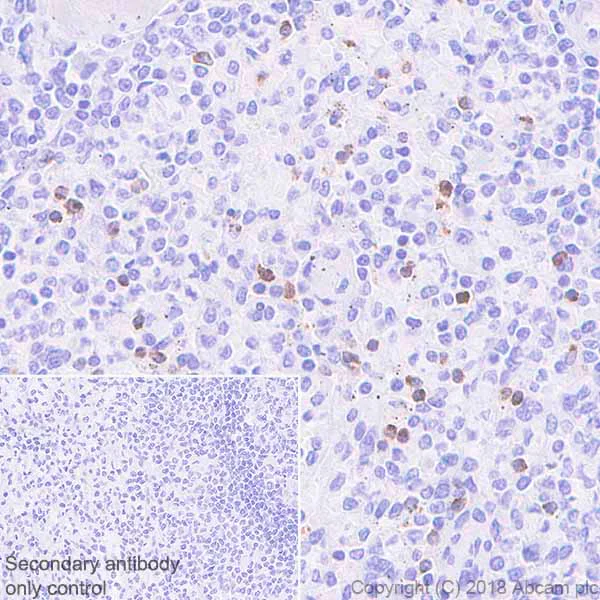 Immunohistochemistry (Formalin/PFA-fixed paraffin-embedded sections) - Anti-GNLY/Granulysin antibody [EPR22110-101] (AB241333)