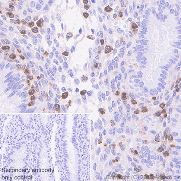 Immunohistochemistry (Formalin/PFA-fixed paraffin-embedded sections) - Anti-GNLY/Granulysin antibody [EPR22110-101] - BSA and Azide free (AB241511)