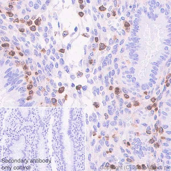Immunohistochemistry (Formalin/PFA-fixed paraffin-embedded sections) - Anti-GNLY/Granulysin antibody [EPR22110-101] - BSA and Azide free (AB241511)