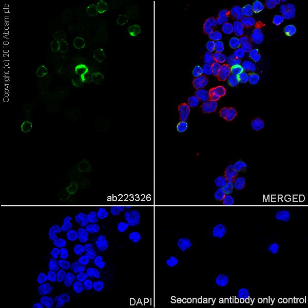 Immunocytochemistry/ Immunofluorescence - Anti-GNLY/Granulysin antibody [EPR22110-128] (AB223326)