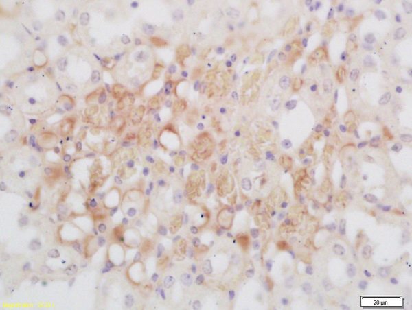 Immunohistochemistry (Formalin/PFA-fixed paraffin-embedded sections) - Anti-GNMT antibody (AB203396)