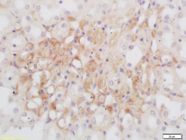 Immunohistochemistry (Formalin/PFA-fixed paraffin-embedded sections) - Anti-GNMT antibody (AB203396)
