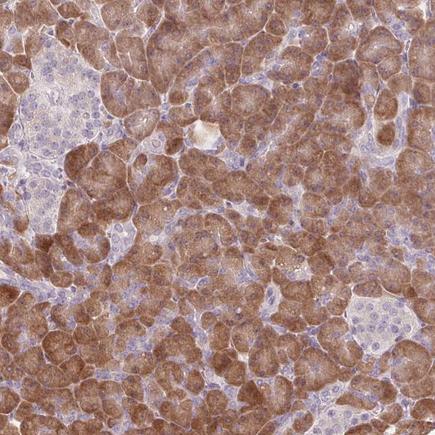 Immunohistochemistry (Formalin/PFA-fixed paraffin-embedded sections) - Anti-GNMT antibody (AB224753), expandable thumbnail