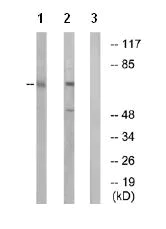 Western blot - Anti-GNPAT/DAPAT antibody (AB75060)