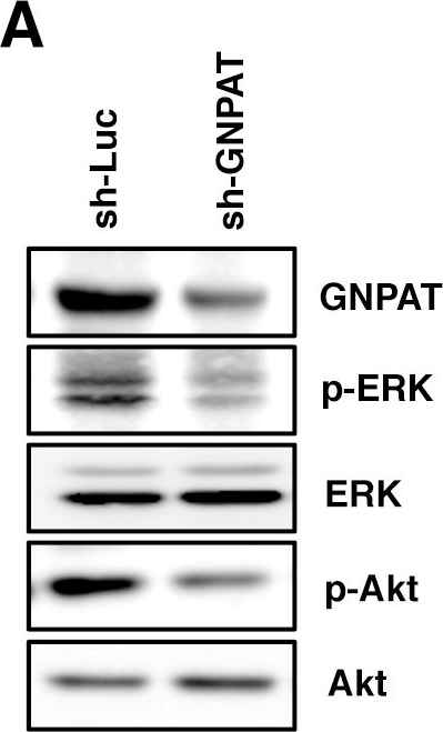 Western blot - Anti-GNPAT/DAPAT antibody (AB75060)