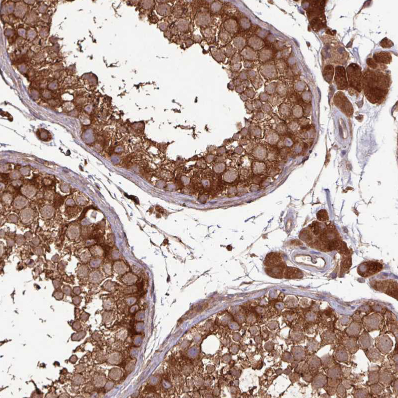 Immunohistochemistry (Formalin/PFA-fixed paraffin-embedded sections) - Anti-GNPDA1 antibody (AB253023), expandable thumbnail