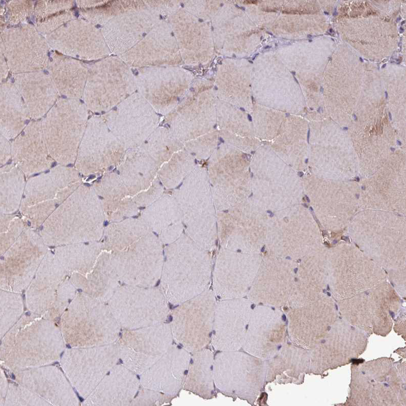 Immunohistochemistry (Formalin/PFA-fixed paraffin-embedded sections) - Anti-GNPDA1 antibody (AB253023), expandable thumbnail