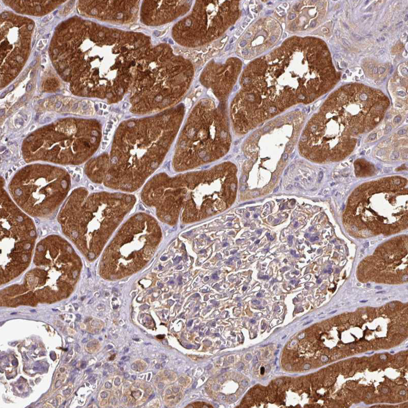 Immunohistochemistry (Formalin/PFA-fixed paraffin-embedded sections) - Anti-GNPDA1 antibody (AB253023), expandable thumbnail