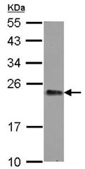 Western blot - Anti-GNPNAT1 antibody (AB127697), expandable thumbnail