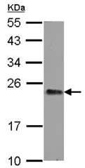 Western blot - Anti-GNPNAT1 antibody (AB127697)