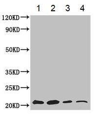 Western blot - Anti-GNPNAT1 antibody (AB234981)