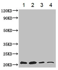 Western blot - Anti-GNPNAT1 antibody (AB234981)