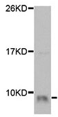 Western blot - Anti-GnRH antibody (AB189878)