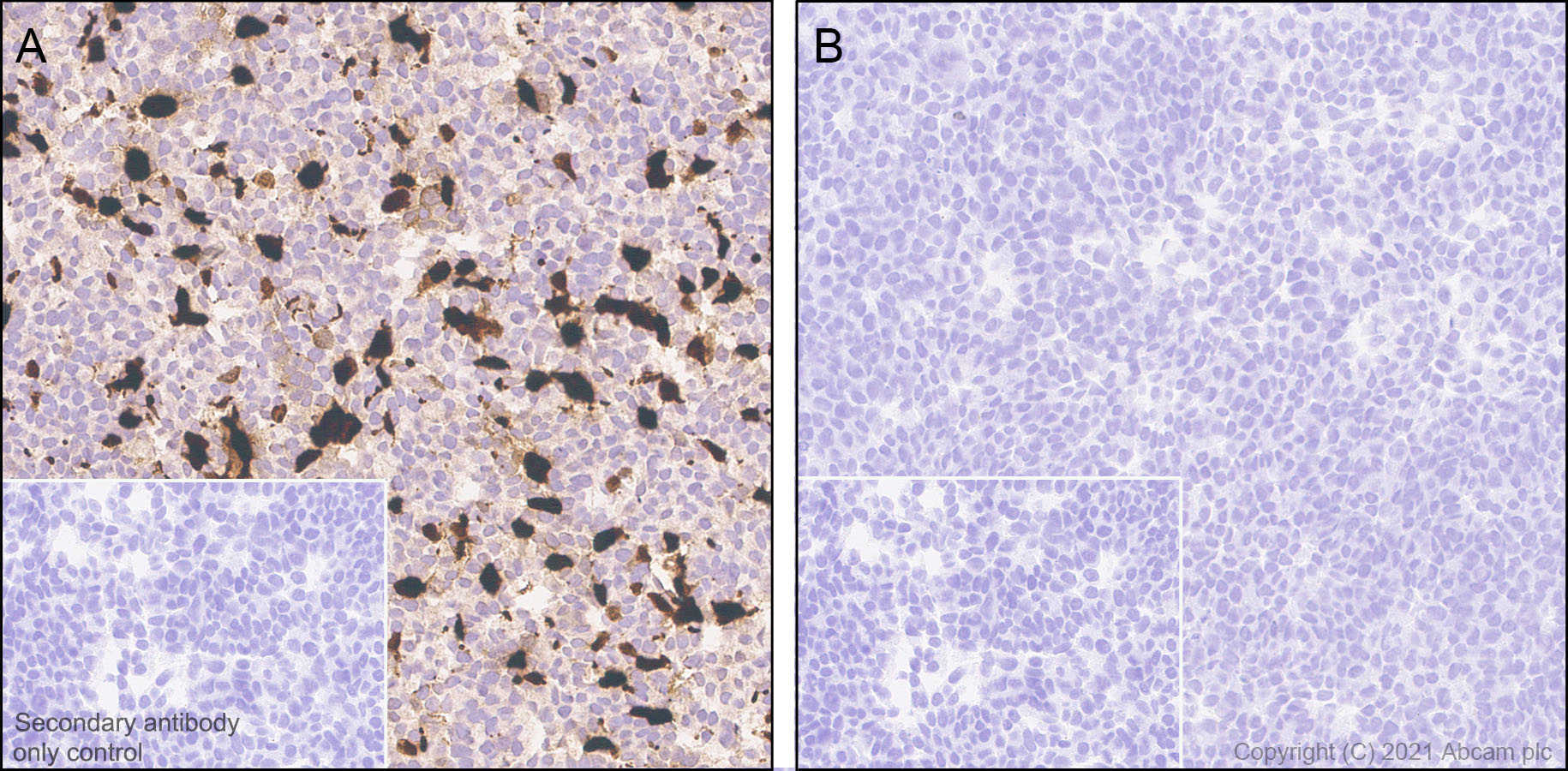 Immunohistochemistry (Formalin/PFA-fixed paraffin-embedded sections) - Anti-GnRH antibody [EPR24529-70] (AB281844), expandable thumbnail