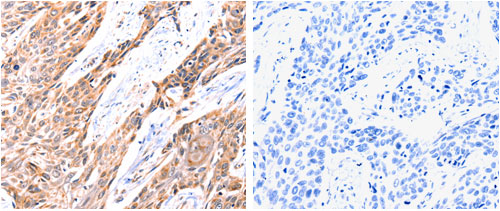 Immunohistochemistry (Formalin/PFA-fixed paraffin-embedded sections) - Anti-GnRHR antibody (AB183079)