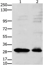 Western blot - Anti-GnRHR antibody (AB183079)