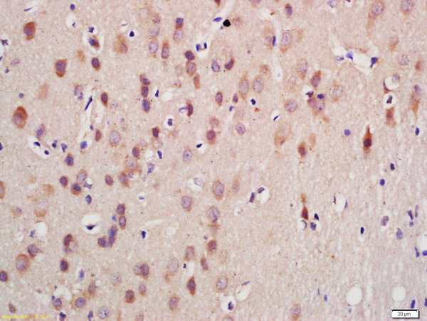 Immunohistochemistry (Formalin/PFA-fixed paraffin-embedded sections) - Anti-GnRHR antibody (AB202848), expandable thumbnail