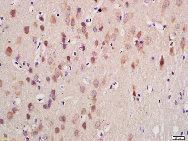 Immunohistochemistry (Formalin/PFA-fixed paraffin-embedded sections) - Anti-GnRHR antibody (AB202848)