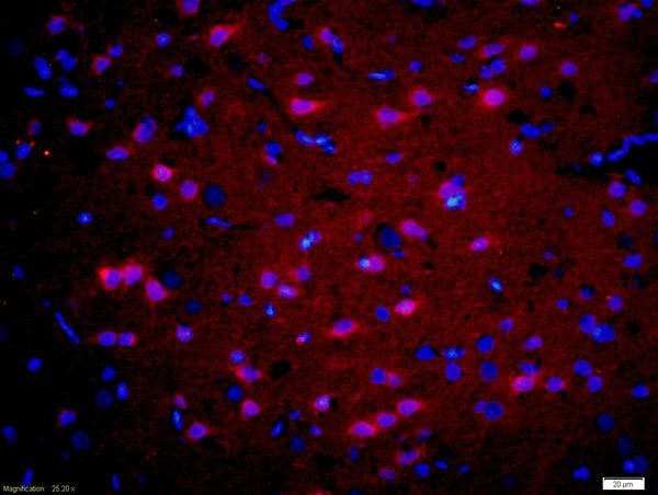 Immunohistochemistry (Formalin/PFA-fixed paraffin-embedded sections) - Anti-GnRHR antibody (AB202848), expandable thumbnail