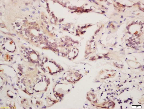 Immunohistochemistry (Formalin/PFA-fixed paraffin-embedded sections) - Anti-GnRHR antibody (AB202848)