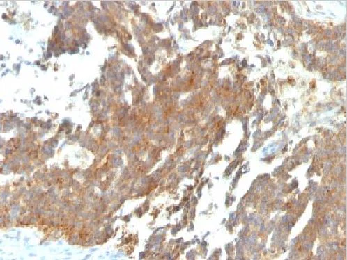 Immunohistochemistry (Formalin/PFA-fixed paraffin-embedded sections) - Anti-GnRHR antibody [GNRHR/768] (AB220196)