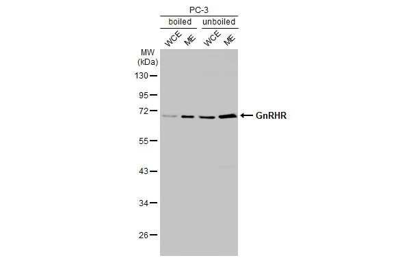 Western blot - Anti-GNRHR antibody [HL2638] - BSA and Azide free (AB325860)