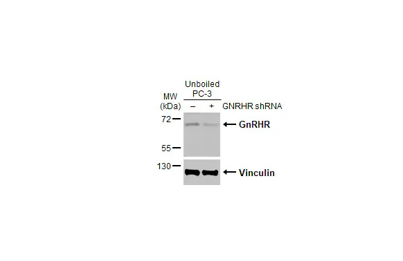 Western blot - Anti-GNRHR antibody [HL2638] - BSA and Azide free (AB325860)