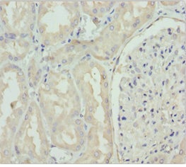 Immunohistochemistry (Formalin/PFA-fixed paraffin-embedded sections) - Anti-GNS antibody (AB230044), expandable thumbnail