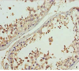 Immunohistochemistry (Formalin/PFA-fixed paraffin-embedded sections) - Anti-GNS antibody (AB230044)