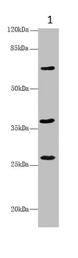 Western blot - Anti-GNS antibody (AB230044)