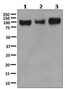 Western blot - Anti-GNS antibody [EPR8329(2)] (AB154177)