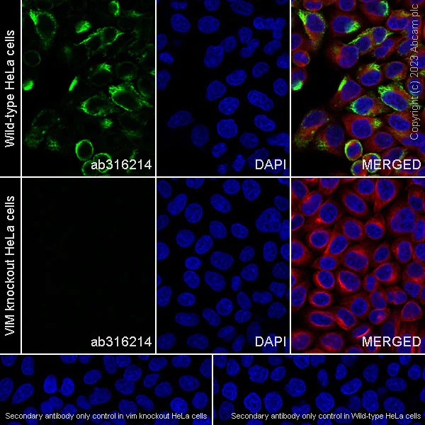 Immunocytochemistry/ Immunofluorescence - Goat Anti-Chicken IgY H&L (Alexa Fluor® 488) preadsorbed (AB150173)