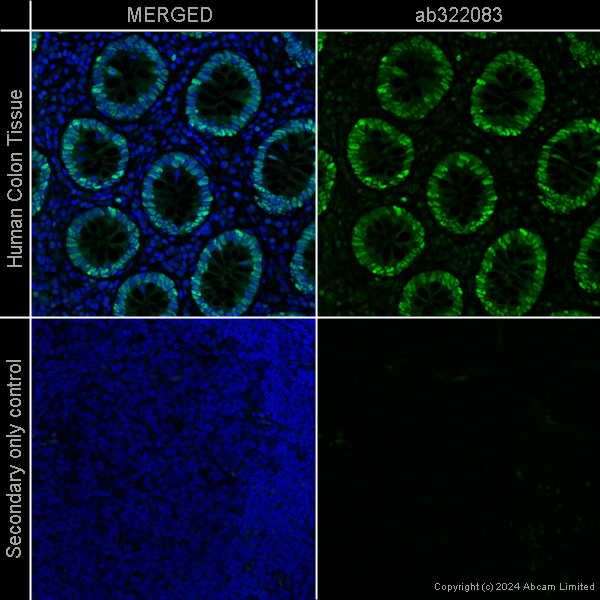 Goat Anti Chicken (IgY) secondary antibody preadsorbed Alexa Goat Anti Chicken (IgY) secondary antibody preadsorbed Alexa