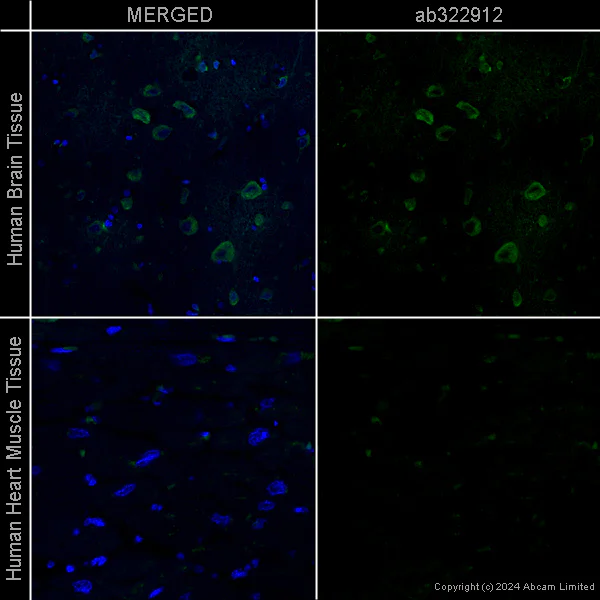 Immunohistochemistry (Formalin/PFA-fixed paraffin-embedded sections) - Goat Anti-Chicken IgY H&L (Alexa Fluor® 488) preadsorbed (AB150173)