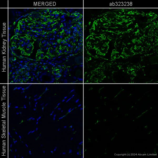 Immunohistochemistry (Formalin/PFA-fixed paraffin-embedded sections) - Goat Anti-Chicken IgY H&L (Alexa Fluor® 488) preadsorbed (AB150173)